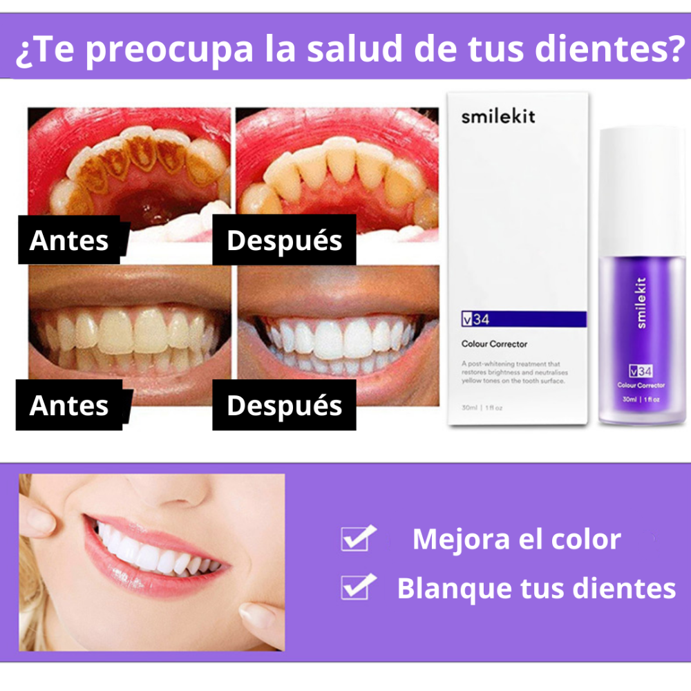 Perlabrite™ Crema blanqueadora dental